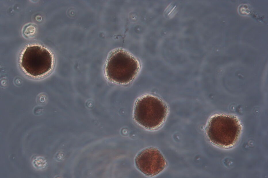 Microalgas nas praias algarvias