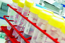 Pesquisa pode ajudar a melhorar o diagnóstico das patologias 