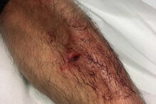 PSP apedrejado em Queluz