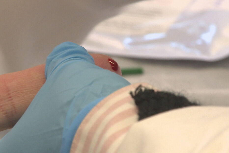 Portugal atingiu as três metas definidas pela ONU no controlo da infeção VIH/Sida