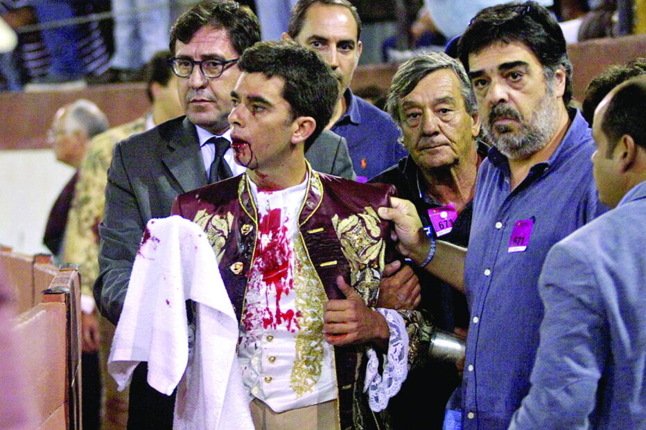 João Moura Jr. foi suturado na cara