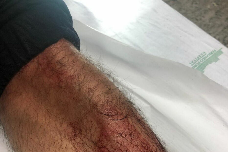 PSP apedrejado em Queluz