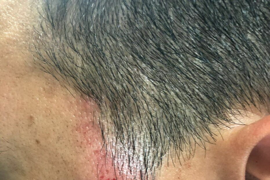 PSP apedrejado em Queluz