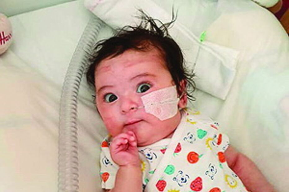 Matilde tomou a segunda dose do Spinraza