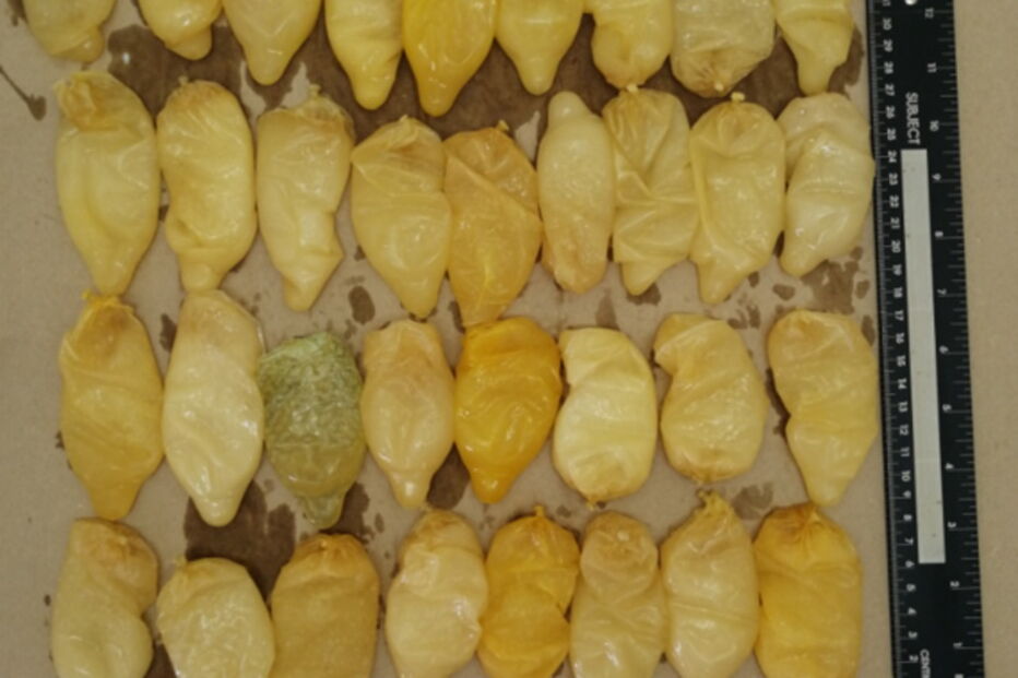 Homem detido no aeroporto de Lisboa com 10 mil doses de cocaína no organismo 