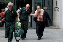 Homem esfaqueado na cara em Londres