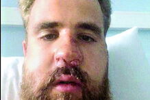 Diogo Tomás terá sido atacado após o jogo e fraturou maxilar