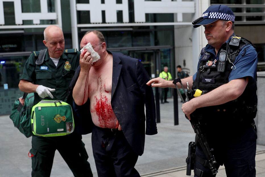 Homem esfaqueado na cara em Londres