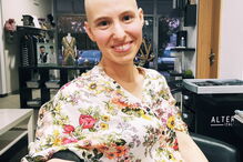 Joana, bloguer dos 'HoneyMooners' rapou o cabelo na luta contra o cancro