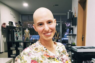 Joana, bloguer dos 'HoneyMooners' rapou o cabelo na luta contra o cancro