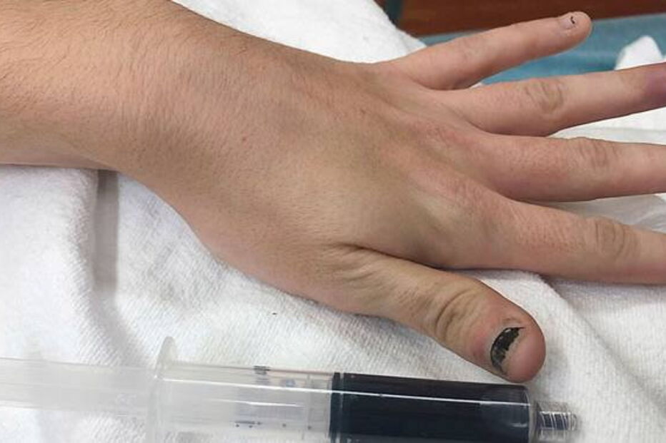 Mulher fica com sangue azul