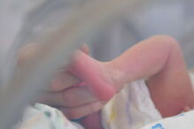 Bebé luta pela vida: nasceu sem olhos, nariz e sem parte do crânio