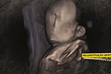 Obstetra que seguiu mãe de bebé sem rosto já tinha cinco queixas na Ordem dos Médicos