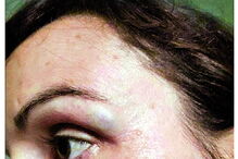 Mulher-polícia também foi hospitalizada