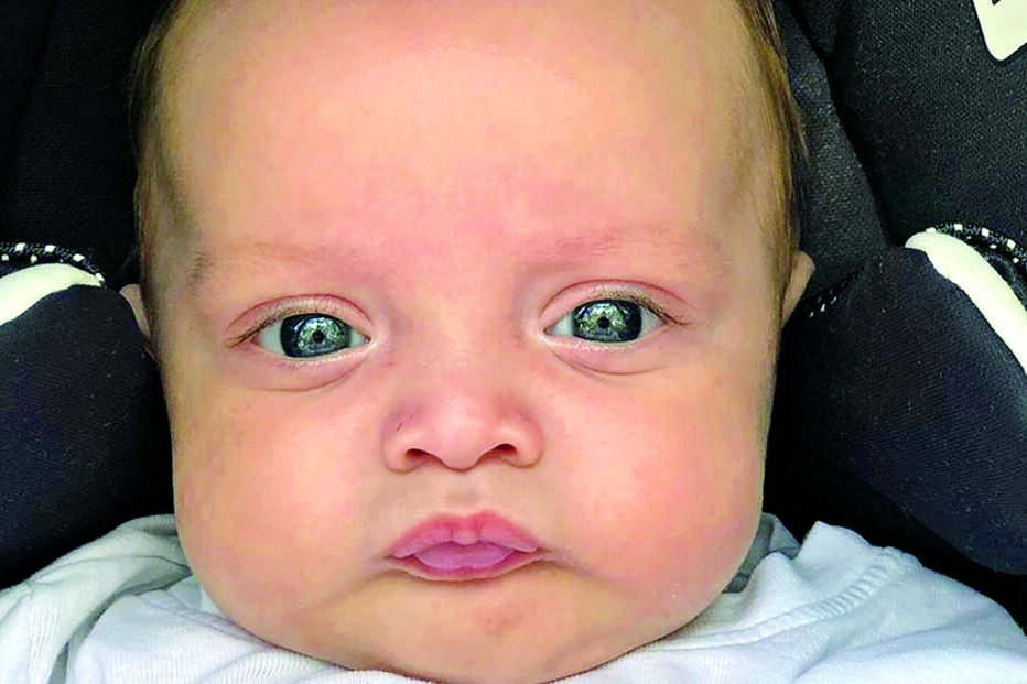 Fotografia onde se vê o rosto de Oliver está a fazer furor nas redes sociais 