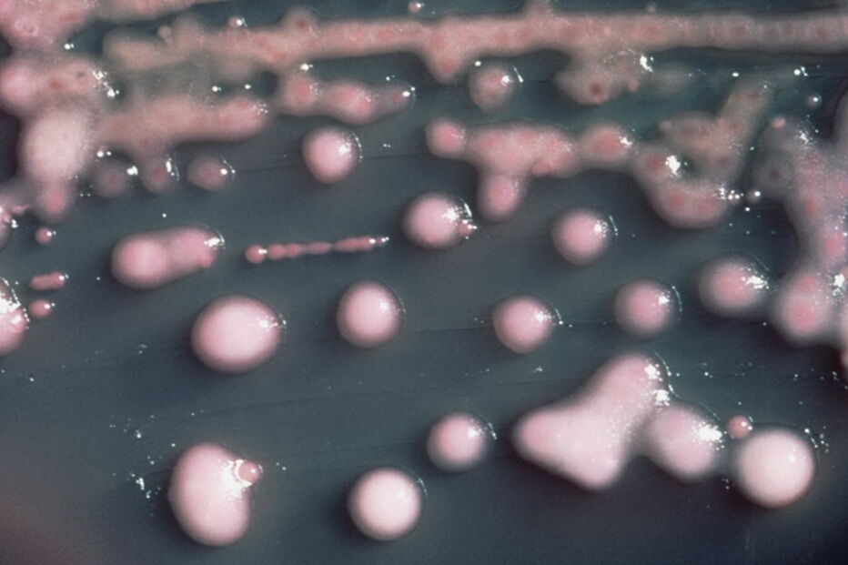 2019-10-11_15_48_50 bactéria.jpg