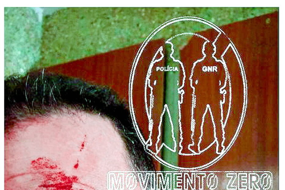 Polícia foi suturado com quatro pontos num sobrolho 