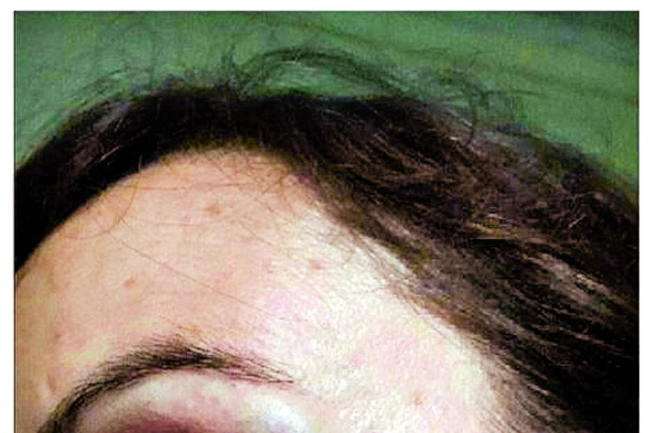 Mulher-polícia também foi hospitalizada