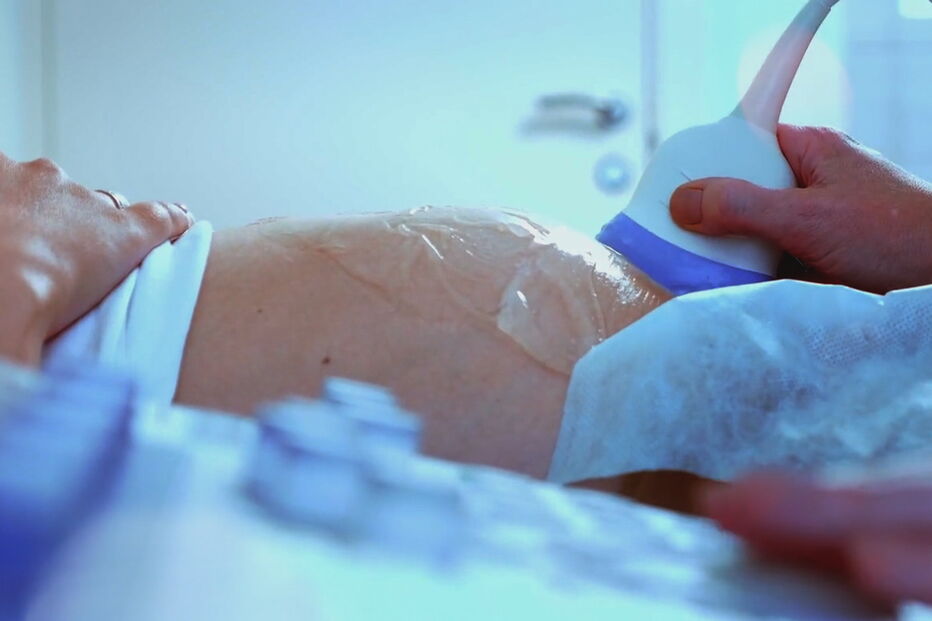 2019-10-21_20_10_31 aborto.jpg