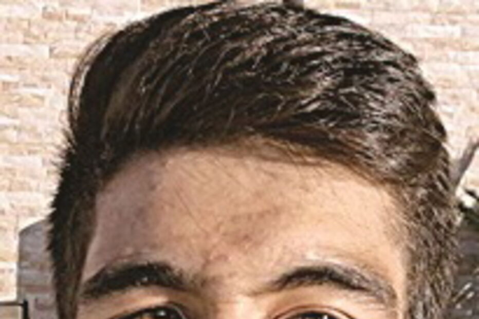 Tiago Frade, de 23 anos, ficou ferido no acidente