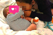 Menino nasceu sem rosto 