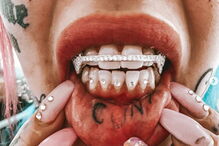 Jovem gasta 23 mil euros para pintar olhos de azul e fica cega