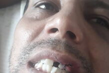 Mulher de adepto do Botafogo espancando: 