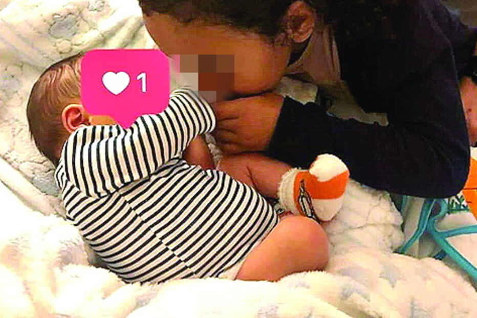 Menino nasceu sem rosto 