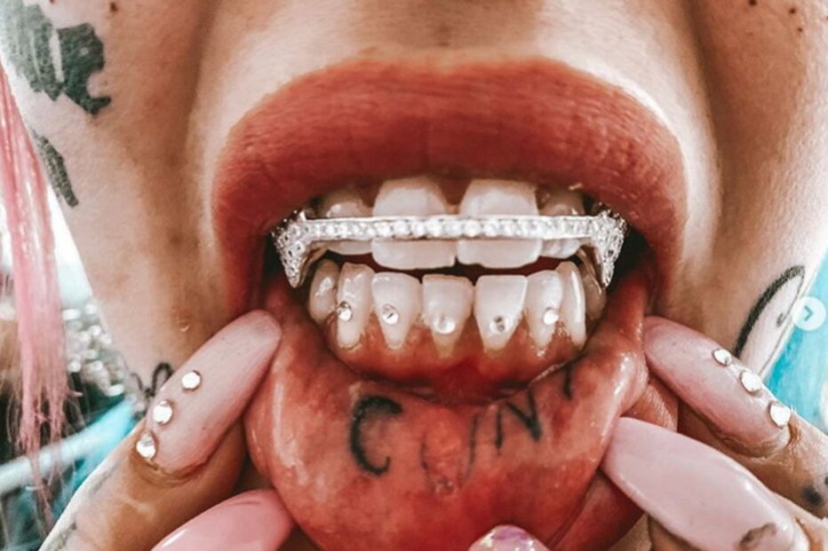 Jovem gasta 23 mil euros para pintar olhos de azul e fica cega