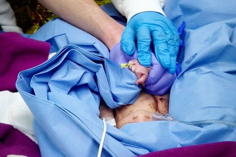 Foto do recém-nascido tirada pelo INEM