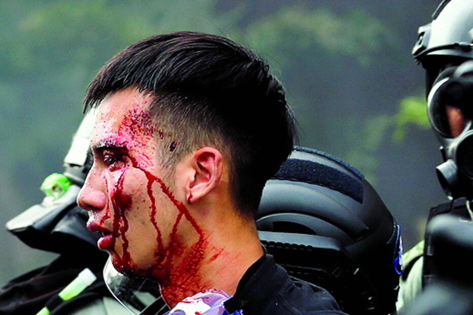 Universidade Politécnica de Hong Kong  foi palco de violentos confrontos durante o fim de semana, com centenas de estudantes a resistirem por todos os meios ao avanço da polícia. Dezenas de pessoas ficaram feridas e as autoridades ameaçaram usar balas verdadeiras após um agente ter sido ferido numa perna por uma flecha