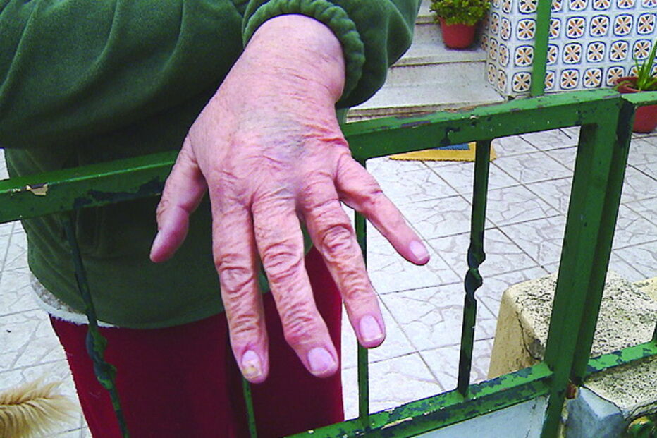 Mulher de 65 anos sofreu ferimentos