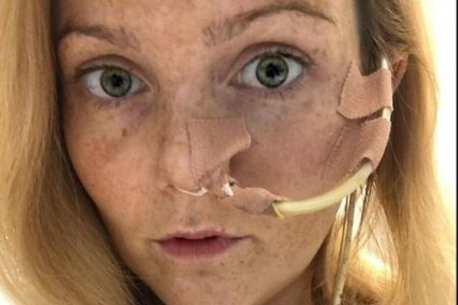 Mulher descobre síndrome que a impede de comer até ao fim da sua vida