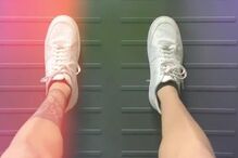 Ângelo mostra pernas durante a fisioterapia