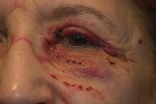 Médica agredida por utente no hospital de Setúbal