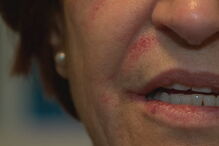 Médica agredida por utente no hospital de Setúbal