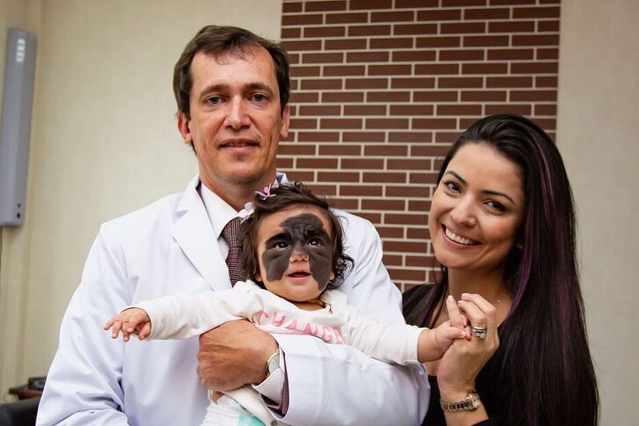 Luna, a menina que nasceu com uma marca na cara que faz lembrar o Batman