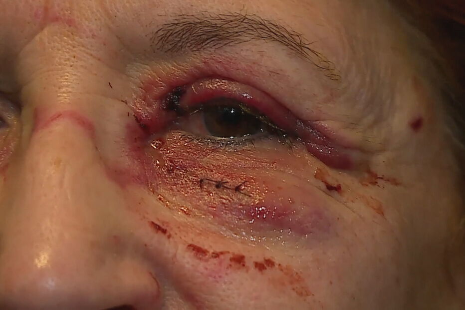 Médica agredida por utente no hospital de Setúbal