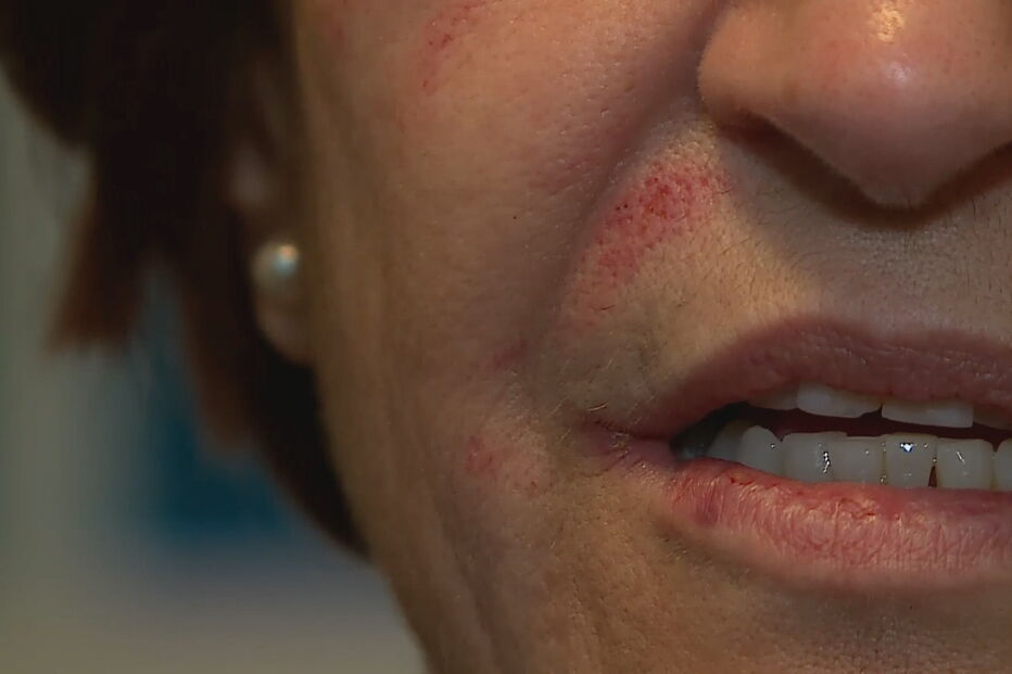 Médica agredida por utente no hospital de Setúbal