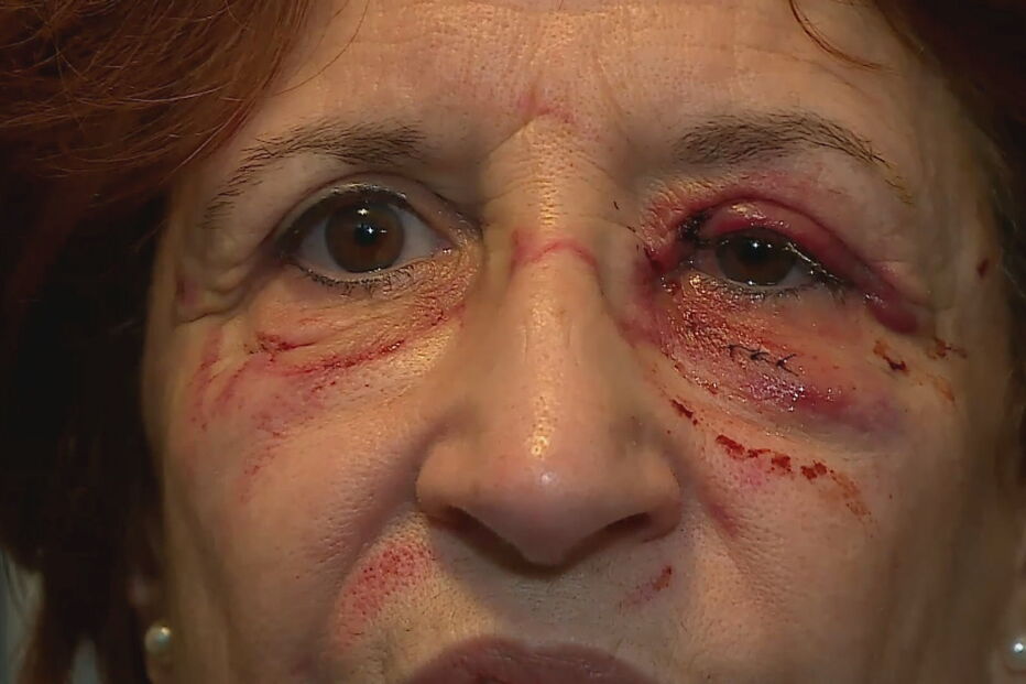 Médica agredida por utente no hospital de Setúbal