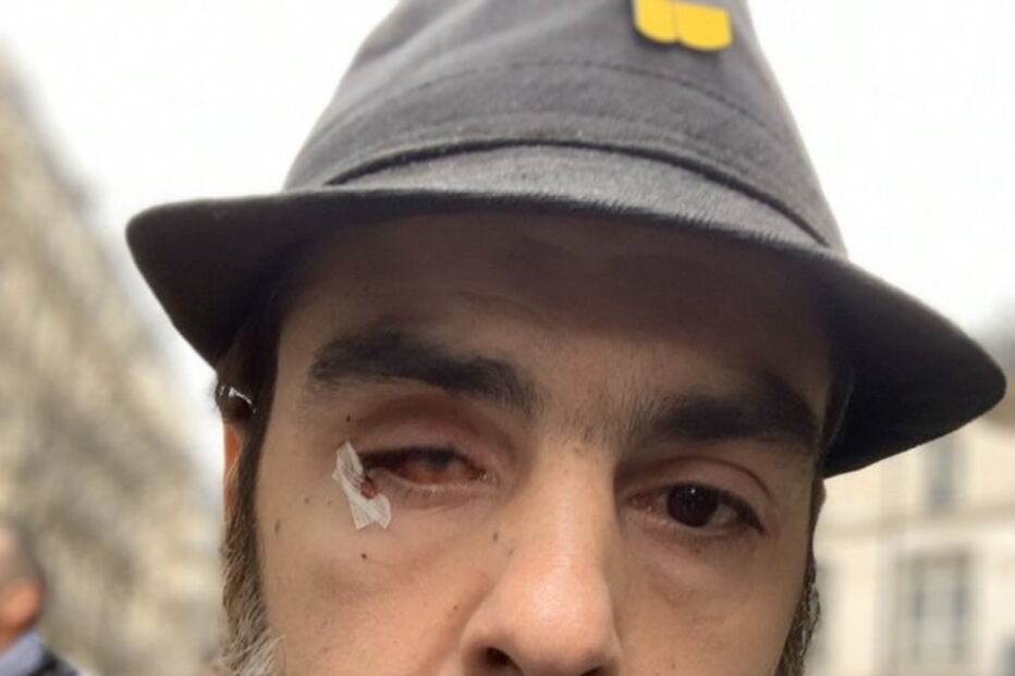 Jerome Rodrigues foi vítima de golpes de um escudo de proteção da polícia