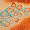 Doentes com sintomas de coronavírus vão ser vistos em casa  