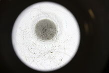 Clínicas de tratamento para piolhos cheias de adolescentes contagiadas em 'selfies'