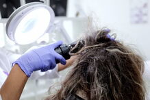 Clínicas de tratamento para piolhos cheias de adolescentes contagiadas em 'selfies'