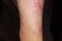 Braços PSP com agressões 