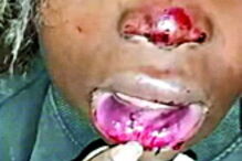 Cláudia Simões foi hospitalizada, assim como o PSP 