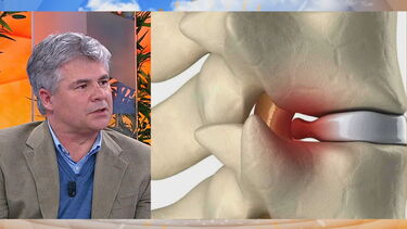 Conheça a cirurgia para tratar a hérnia discal