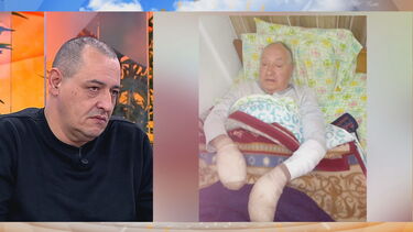 A história do pai de João: Homem tem 60% do corpo queimado e pode ficar sem mãos