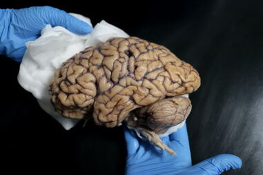 Associação alerta para falta de respostas para vítimas de danos cerebrais adquiridos