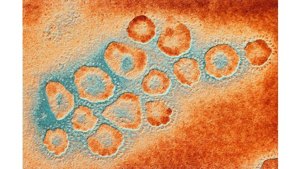 Coronavírus: Conheça os sintomas, saiba como se proteger e o que fazer se for viajar